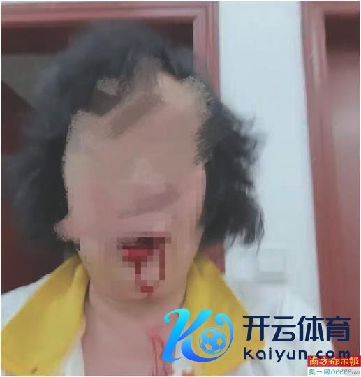 阿婆被退管所东说念主员打伤获补偿 两边收尾调和公约